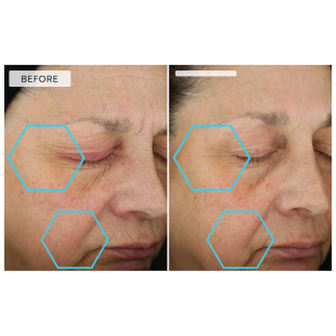 Dermaquest Peptide 3D Eye Lift 15ml