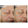 Dermaquest Peptide 3D Eye Lift 15ml
