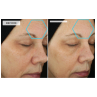 Dermaquest Peptide 3D Eye Lift 15ml