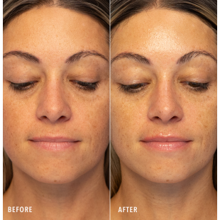 HydroPeptide HydroLuxe Oxygen Facial