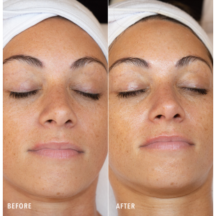 HydroPeptide HydroLuxe Oxygen Facial