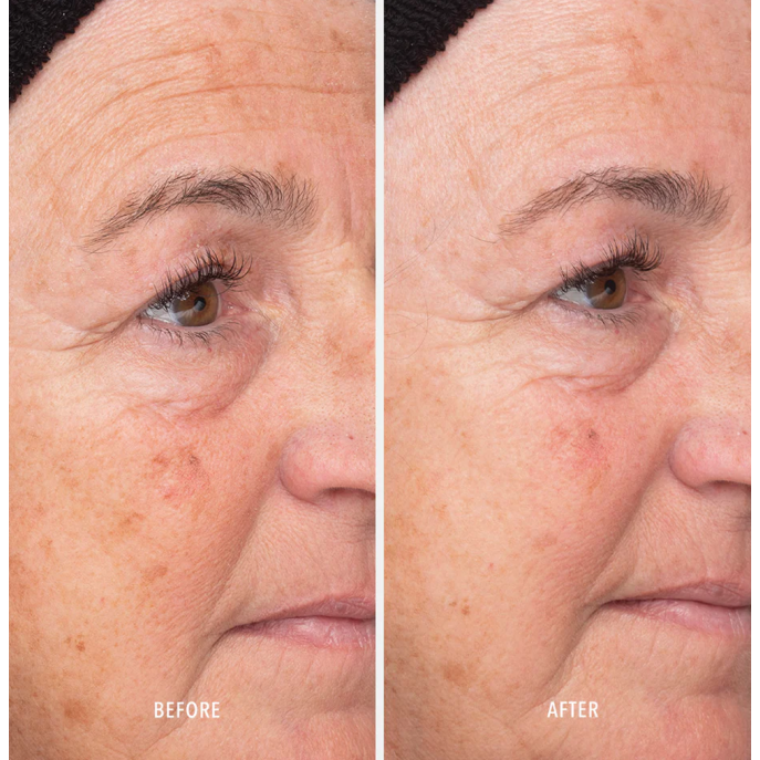 HydroPeptide Liquid Resurfacing Solution 120ml