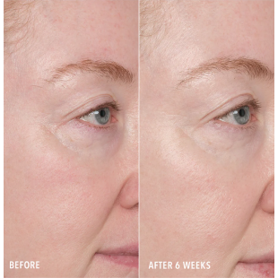 HydroPeptide Resurface & Repair Peptide Pads 30 gab