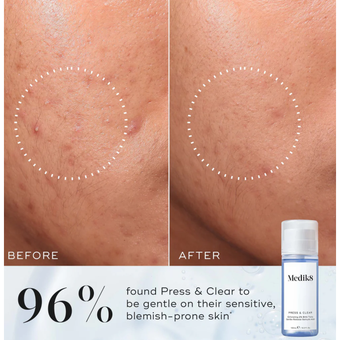 Medik8 Press & Clear 150ml