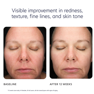 PCA Skin Triple Exfoliation Peel Pads 30pads