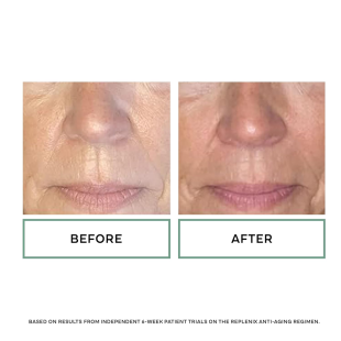 Replenix Glycolic Acid 20% Resurfacing Cream 50ml