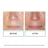 Replenix Glycolic Acid 20% Resurfacing Cream 50ml