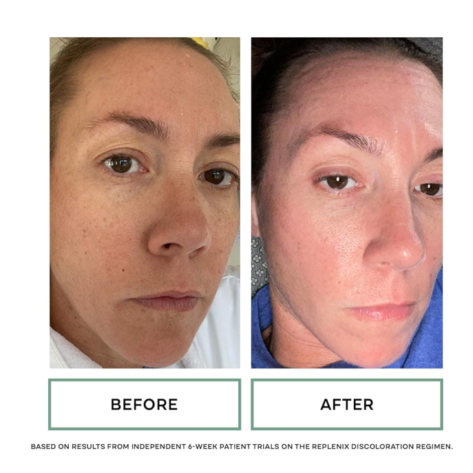 Replenix Glycolic Acid Resurfacing Cleanser 200ml