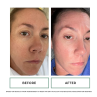 Replenix Glycolic Acid Resurfacing Cleanser 200ml
