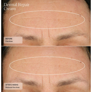 Senté Dermal Repair Cream 30ml