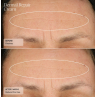 Senté Dermal Repair Cream 30ml