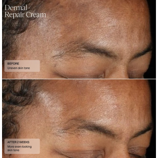 Senté Dermal Repair Cream 30ml