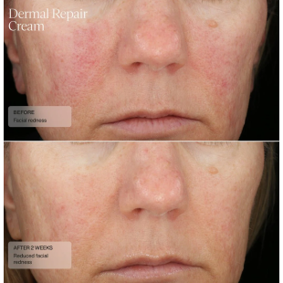 Senté Dermal Repair Cream 30ml
