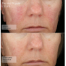 Senté Dermal Repair Cream 30ml