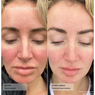Senté Dermal Repair Cream 30ml