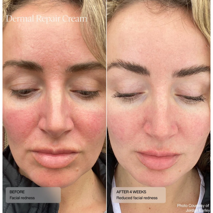 Senté Dermal Repair Cream 30ml