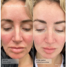 Senté Dermal Repair Cream 30ml