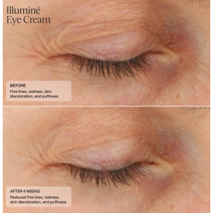 Senté Illuminé Eye Cream 15ml