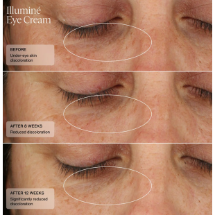 Senté Illuminé Eye Cream 15ml
