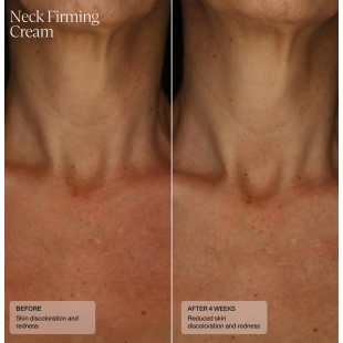 Senté Neck Firming Cream 50 ml
