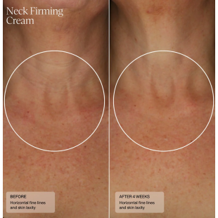 Senté Neck Firming Cream 50 ml