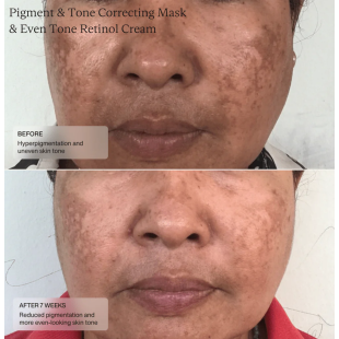 Senté Pigment & Tone Correcting Mask 50ml
