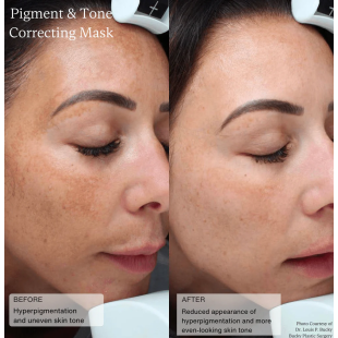 Senté Pigment & Tone Correcting Mask 50ml
