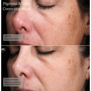 Senté Pigment & Tone Correcting Mask 50ml