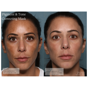 Senté Pigment & Tone Correcting Mask 50ml