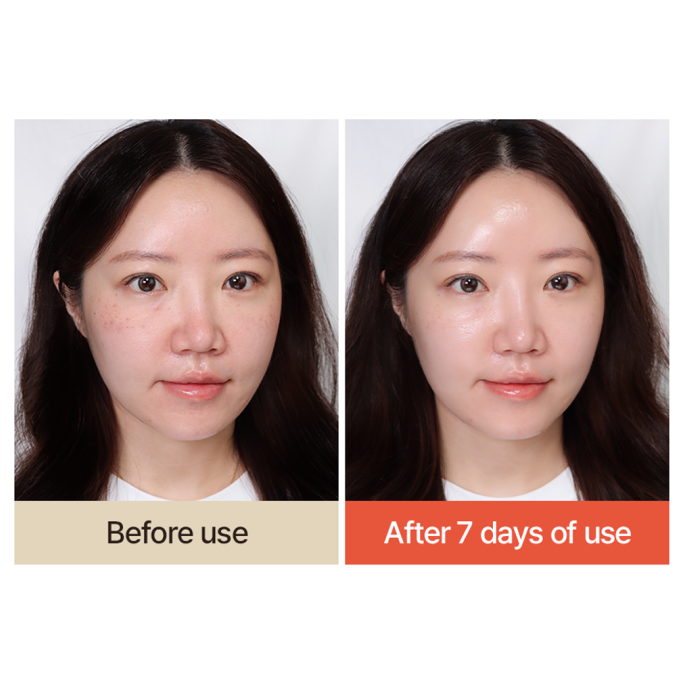 T'else Red Orange Niacinamide Serum 30ml