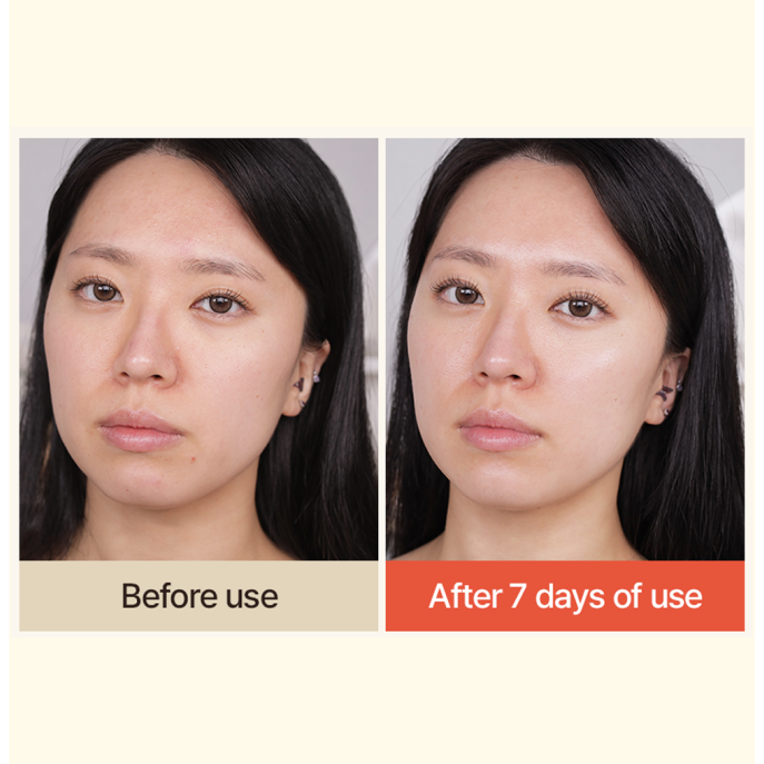 T'else Red Orange Niacinamide Toner 150ml