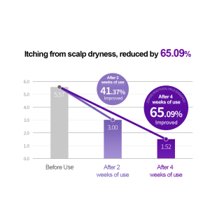 Zeroid Rootheal Mild Shampoo 300ml