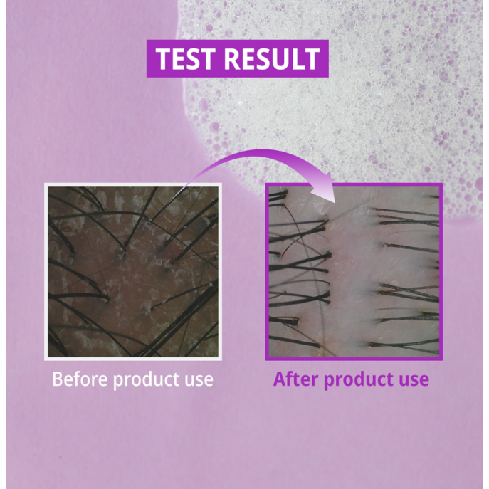 Zeroid Rootheal Mild Shampoo 300ml