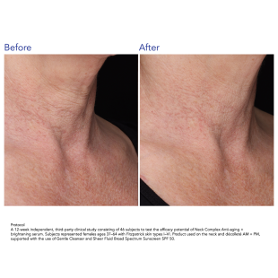 ZO Skin Health Neck Complex 50ml