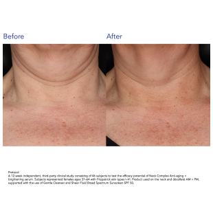 ZO Skin Health Neck Complex 50ml