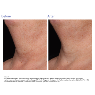 ZO Skin Health Neck Complex 50ml